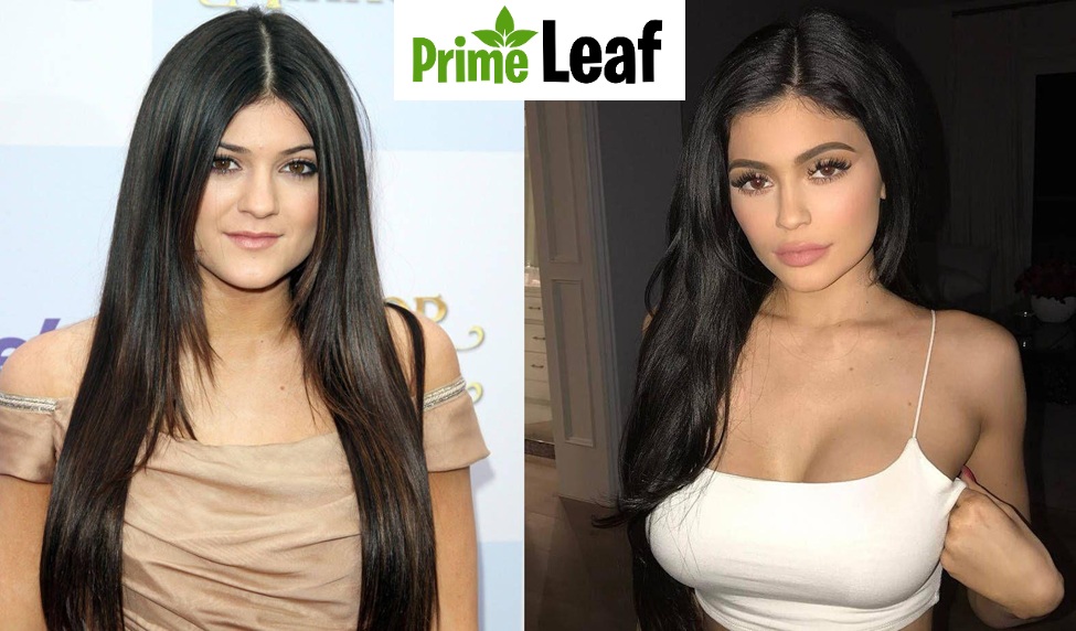 Kylie Jenner Then Vs Now