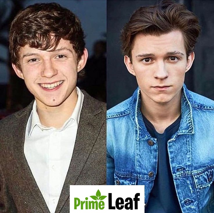 Tom Holland Then vs Now 