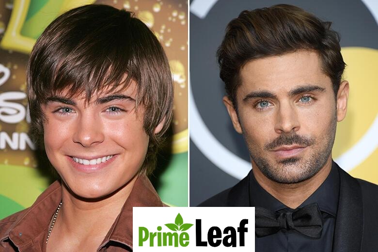 Zac Efron Then Vs Now